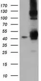 Anti-DNAJA2 antibody [3A1] used in Western Blot (WB). GTX84610