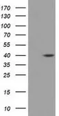 Anti-DHPS antibody [2C9] used in Western Blot (WB). GTX84616