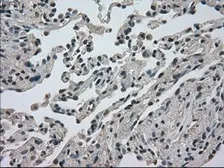 Anti-DHFR antibody [3A11] used in IHC (Paraffin sections) (IHC-P). GTX84618