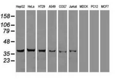 Anti-ICAD antibody [3F12] used in Western Blot (WB). GTX84620