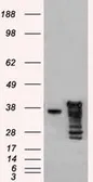 Anti-ICAD antibody [5C4] used in Western Blot (WB). GTX84621