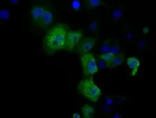 Anti-DCXR antibody [4D11] used in Immunocytochemistry/ Immunofluorescence (ICC/IF). GTX84623