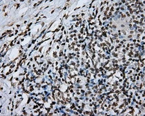 Anti-DAP Kinase 2 antibody [1F7] used in IHC (Paraffin sections) (IHC-P). GTX84630