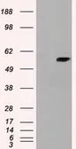 Anti-Cyp7b1 antibody [7H10] used in Western Blot (WB). GTX84633