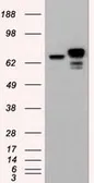 Anti-beta Catenin antibody [1F3] used in Western Blot (WB). GTX84650