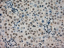 Anti-CTAG1B antibody [3C9] used in IHC (Paraffin sections) (IHC-P). GTX84652
