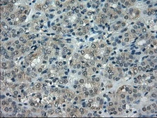 Anti-alpha B Crystallin antibody [6D11] used in IHC (Paraffin sections) (IHC-P). GTX84657