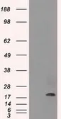 Anti-alpha B Crystallin antibody [6A9] used in Western Blot (WB). GTX84659