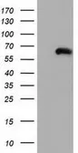 Anti-Coronin 1B antibody [3D10] used in Western Blot (WB). GTX84676