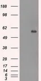 Anti-CNDP1 antibody [2F8] used in Western Blot (WB). GTX84677