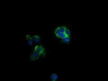 Anti-CLPP antibody [1D3] used in Immunocytochemistry/ Immunofluorescence (ICC/IF). GTX84678