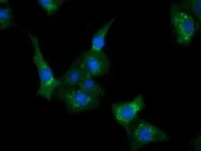 Anti-CLPP antibody [1D8] used in Immunocytochemistry/ Immunofluorescence (ICC/IF). GTX84679