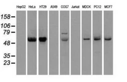 Anti-Chk2 antibody [2F4] used in Western Blot (WB). GTX84685