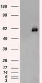 Anti-Chk2 antibody [5C4] used in Western Blot (WB). GTX84691
