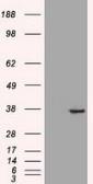 Anti-CDX2 antibody [1A3] used in Western Blot (WB). GTX84694