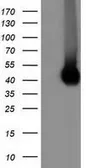 Anti-CD80 antibody [1E9] used in Western Blot (WB). GTX84698