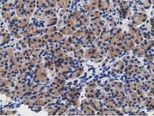 Anti-CD80 antibody [2E5] used in IHC (Paraffin sections) (IHC-P). GTX84700