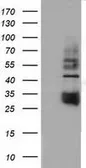 Anti-CD80 antibody [7H3] used in Western Blot (WB). GTX84702