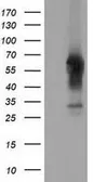 Anti-CD5 antibody [2B8] used in Western Blot (WB). GTX84708