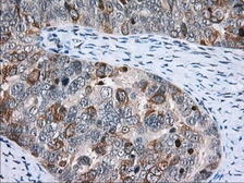 Anti-CD5 antibody [7A7] used in IHC (Paraffin sections) (IHC-P). GTX84709