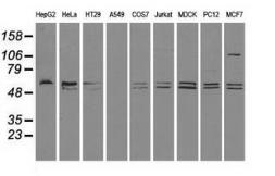 Anti-CD4 antibody [10B5] used in Western Blot (WB). GTX84720