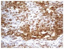 Anti-CD2 antibody [4E4] used in IHC (Paraffin sections) (IHC-P). GTX84724