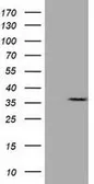 Anti-CAPZA1 antibody [7C8] used in Western Blot (WB). GTX84736