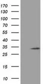 Anti-C16orf72 antibody [3B4] used in Western Blot (WB). GTX84758