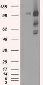 Anti-BUB1B antibody [11G2] used in Western Blot (WB). GTX84768