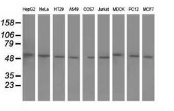Anti-BTN1A1 antibody [5E6] used in Western Blot (WB). GTX84775