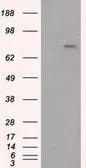 Anti-BTK antibody [3A2] used in Western Blot (WB). GTX84789