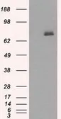 Anti-BTK antibody [12H4] used in Western Blot (WB). GTX84792