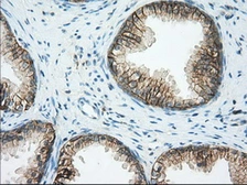 Anti-CD147 antibody [4D3] used in IHC (Paraffin sections) (IHC-P). GTX84799