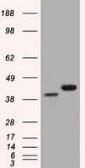 Anti-CD147 antibody [9H5] used in Western Blot (WB). GTX84801