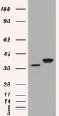 Anti-CD147 antibody [9H5] used in Western Blot (WB). GTX84801