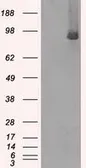 Anti-B-Raf antibody [1D2] used in Western Blot (WB). GTX84807