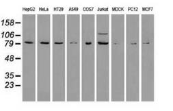 Anti-B-Raf antibody [3A7] used in Western Blot (WB). GTX84812