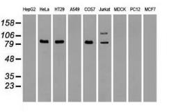 Anti-B-Raf antibody [4B2] used in Western Blot (WB). GTX84814