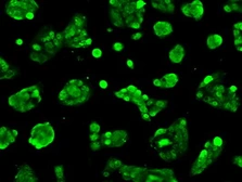 Anti-Livin antibody [1B10] used in Immunocytochemistry/ Immunofluorescence (ICC/IF). GTX84822