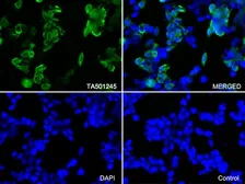 Anti-Survivin antibody [2D9] used in Immunocytochemistry/ Immunofluorescence (ICC/IF). GTX84824