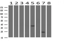 Anti-Survivin antibody [2D9] used in Western Blot (WB). GTX84824