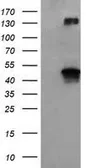 Anti-BHMT antibody [10B3] used in Western Blot (WB). GTX84827