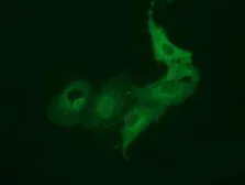 Anti-Bestrophin 3 antibody [1B6] used in Immunocytochemistry/ Immunofluorescence (ICC/IF). GTX84830