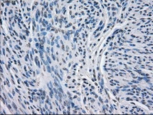 Anti-BCKDK antibody [11C9] used in IHC (Paraffin sections) (IHC-P). GTX84836