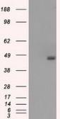 Anti-BCKDK antibody [11C9] used in Western Blot (WB). GTX84836