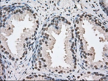 Anti-BAT1 antibody [2C5] used in IHC (Paraffin sections) (IHC-P). GTX84837