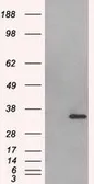 Anti-Aurora C antibody [2B7] used in Western Blot (WB). GTX84840