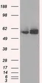 Anti-ATP5B antibody [7F4] used in Western Blot (WB). GTX84843