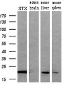 Anti-Apolipoprotein M antibody [3H3] used in Western Blot (WB). GTX84882