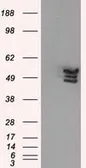 Anti-Annexin XI antibody [1C6] used in Western Blot (WB). GTX84884